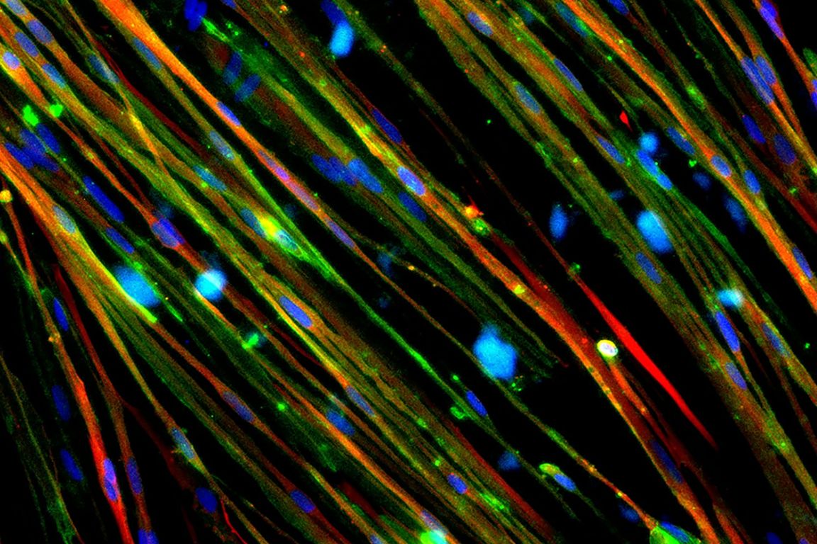 Colorful strands showing restoration of dystrophin (stained green) in Duchenne muscular dystrophy muscle cells