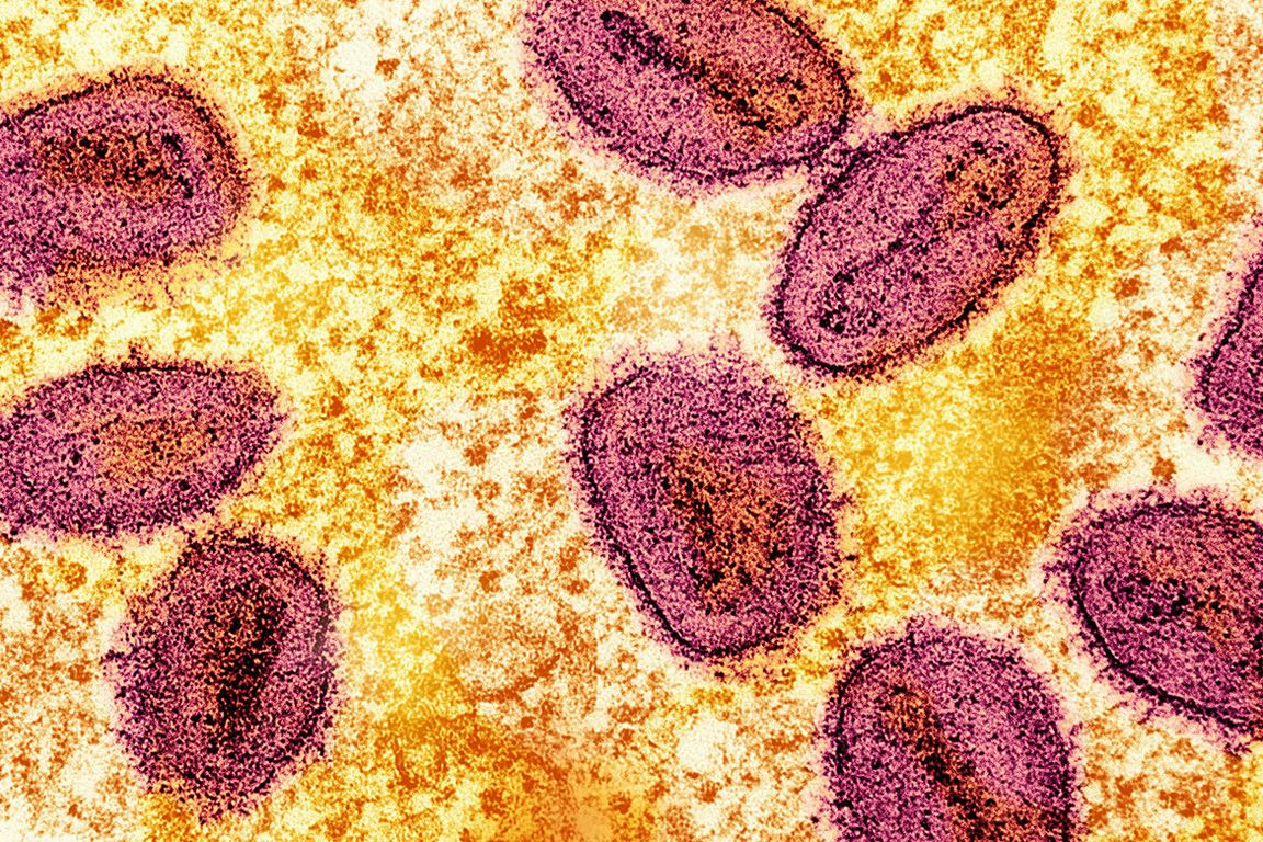 UCLA Fielding faculty drive improved methods to research spread of infectious viral diseases