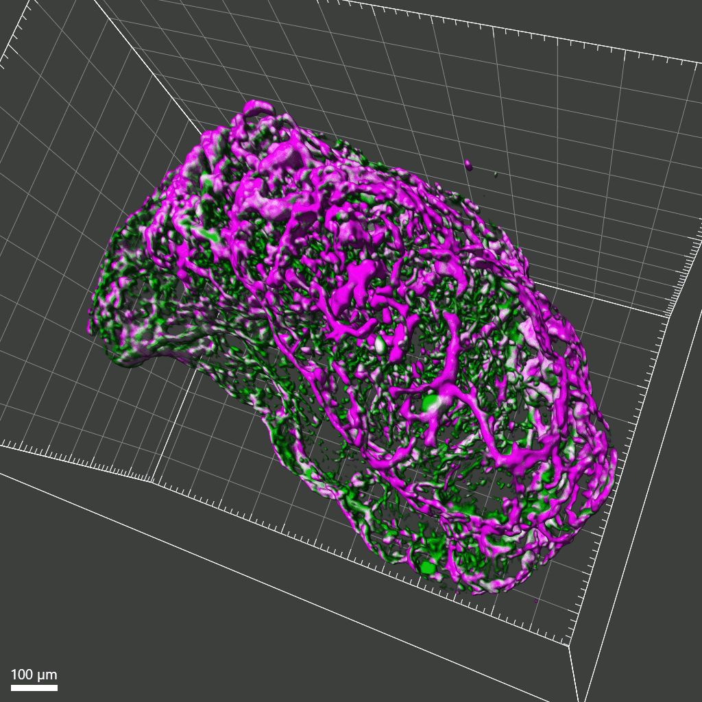 A 3D microscopy image of a blood vessel organoid, showing a textured, oval-shaped structure in magenta and green fluorescent colors against a dark gridded background, with a 100-micron scale bar.