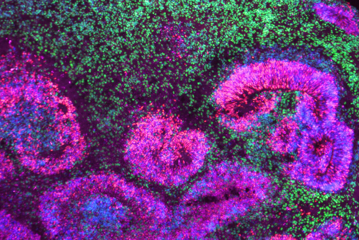 Photo | Microscopy image of cortical organoid showing clusters of ...