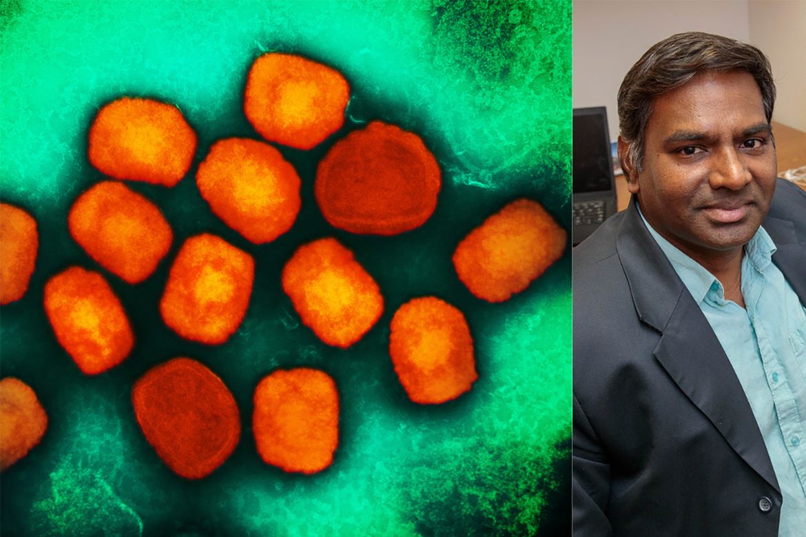 Colorized microscopy image of mpox virus particles (orange), right, and Vaithi Arumugaswami in blue button-down and dark gray jacket
