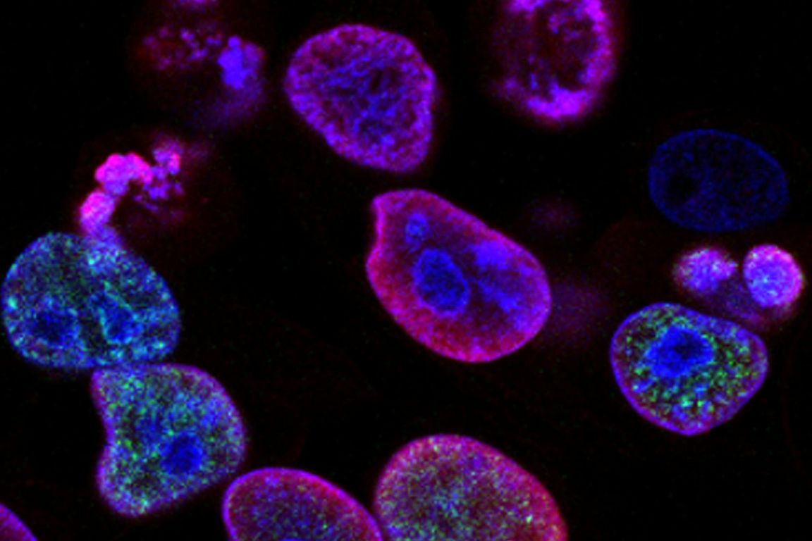 Colorectal cancer cells