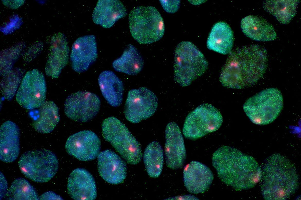 stemcells_726207f0-f563-45d2-