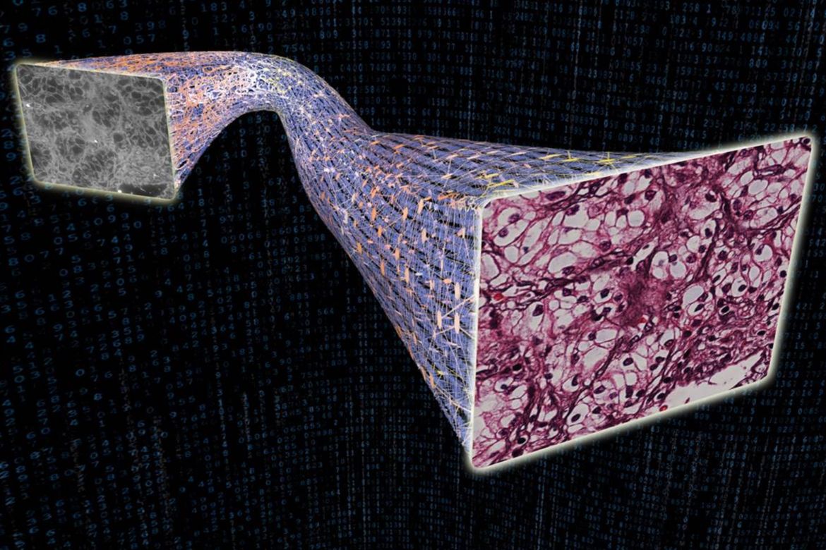 A (gray) unstained microscopic image at left and a pink AI-painted version at right. 