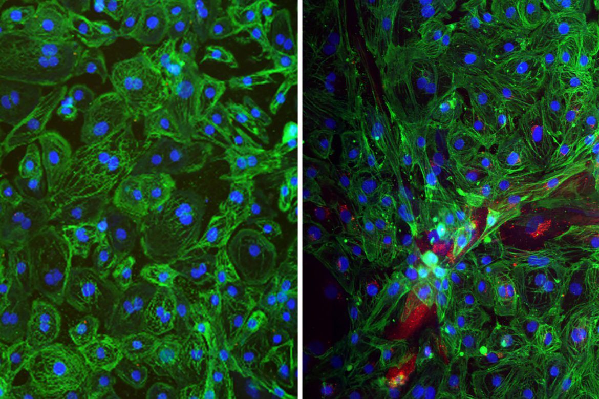 Microscopy images of human stem cell-derived mini-heart organoids; healthy cells on left, hantavirus-infected cells (red) on right