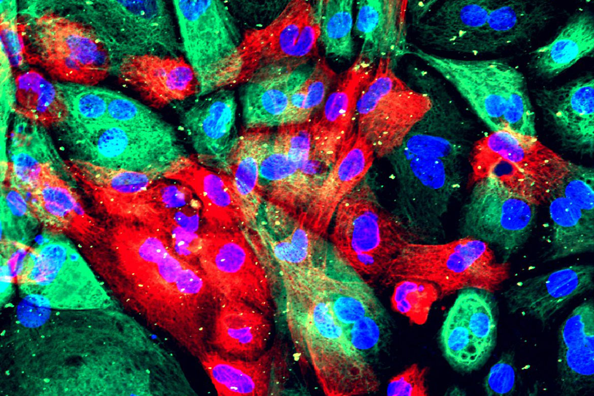Wild type human prostate cells from an organoid. A colorful view of wild type human prostate cells from an organoid (a man-made construct that resembles an organ).