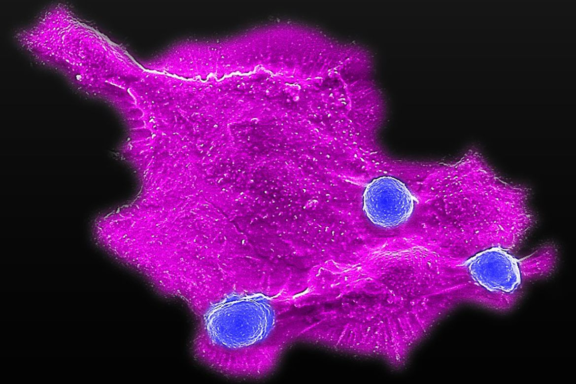 Cancer Center Care | Penn State Health, image size:1169x779