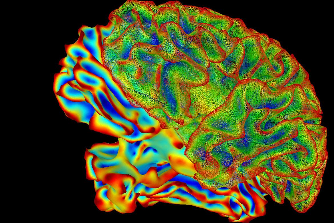 Photo | A false-color 3D rendering of a human brain shown in profile ...