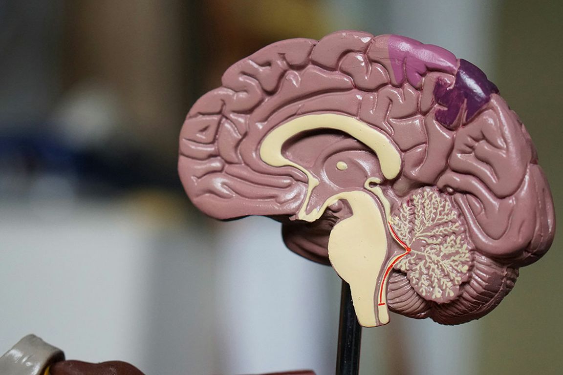A cross-sectional anatomical model of the human brain showing internal structures.