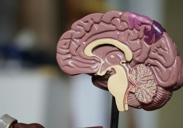 Scientists uncover why some brain cells resist Alzheimer's disease | UCLA