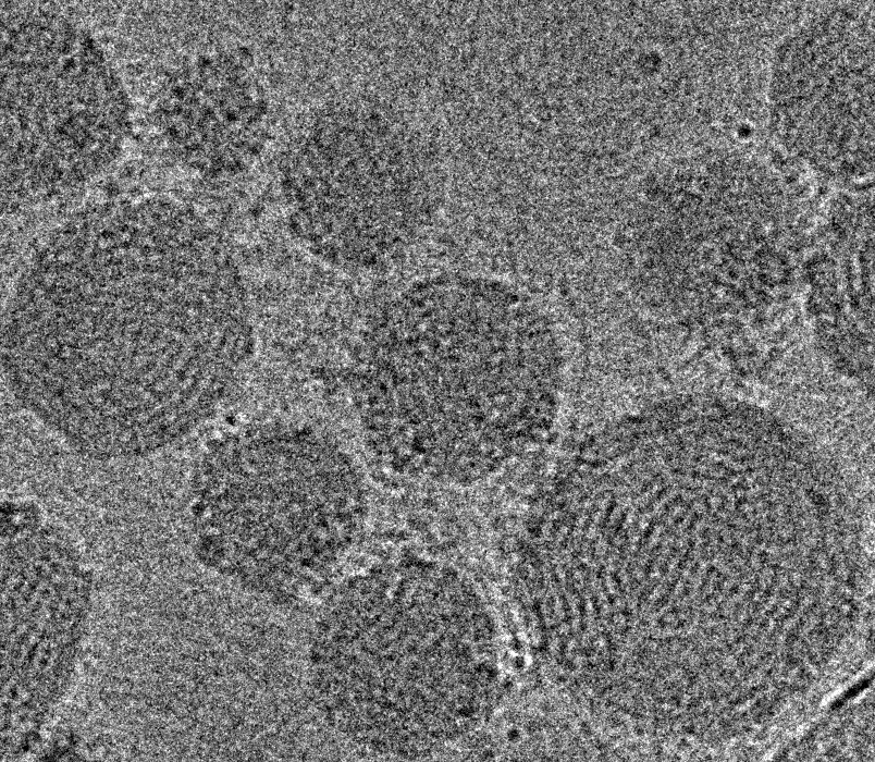 Representative cryo-TEM images of lipid nanoparticles carrying CRISPR/Cas9 gene editing components, including a Cas9-encoding mRNA, guide RNA, and a linear double stranded DNA template of the CFTR gene. 