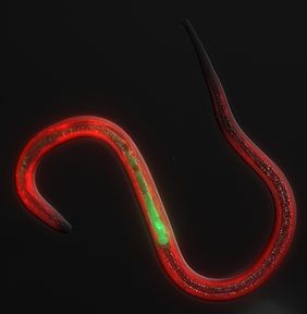 A fluorescence microscopy a Strongyloides stercoralis infective larva