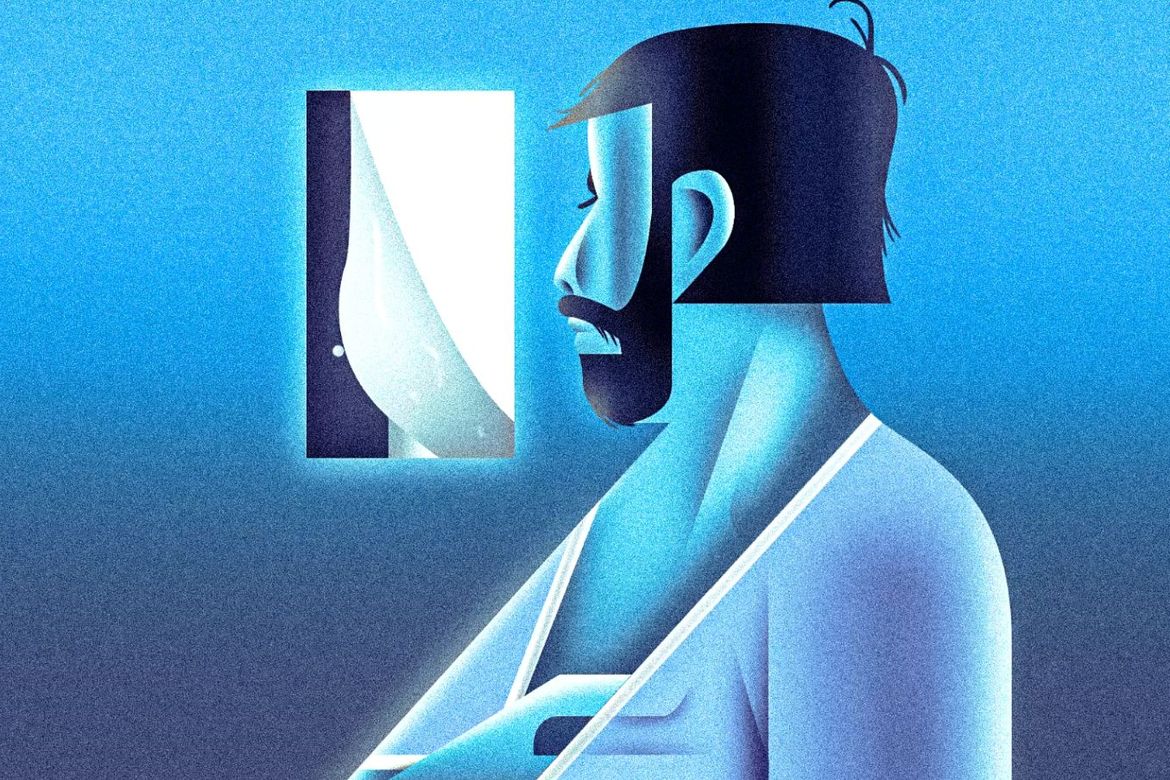 An illustration depicts a man in a medical gown looking at a mammogram image, rendered in shades of blue.