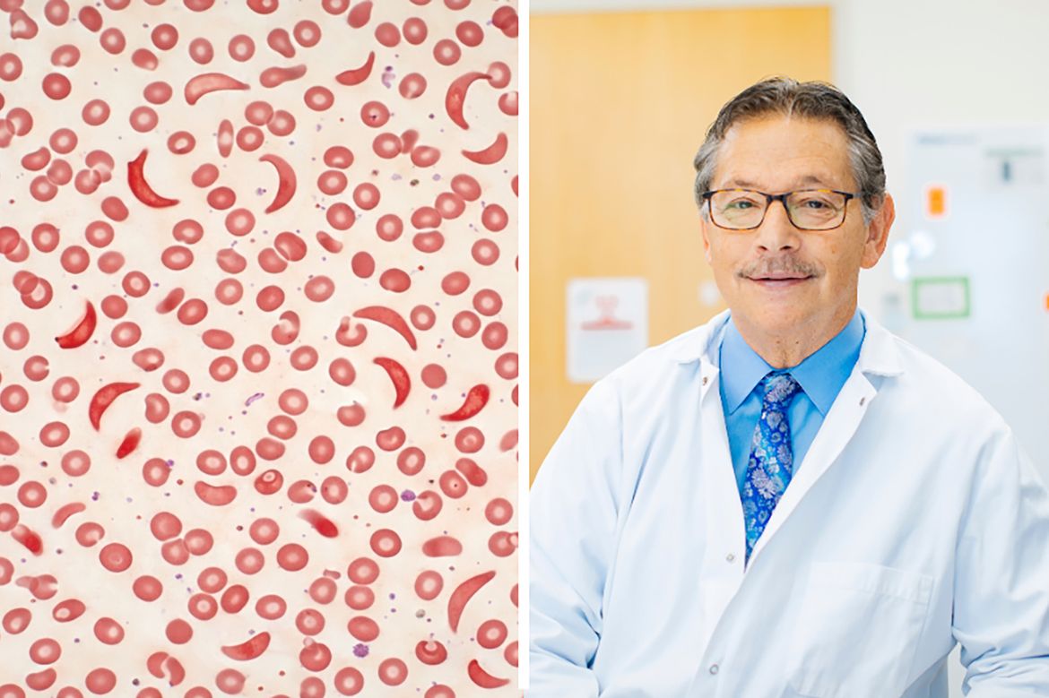 Composite of AI-generated illustration of red blood cells, left, and Donald Kohn in white coat and blue button-down and tie 