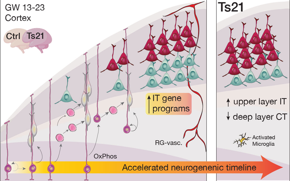 Schematic summarizing cellular and molecular alterations in the development of the Down syndrome neocortex.
