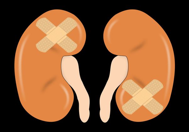 Illustration of two kidneys, each with a crossed bandage, representing kidney injury or disease.