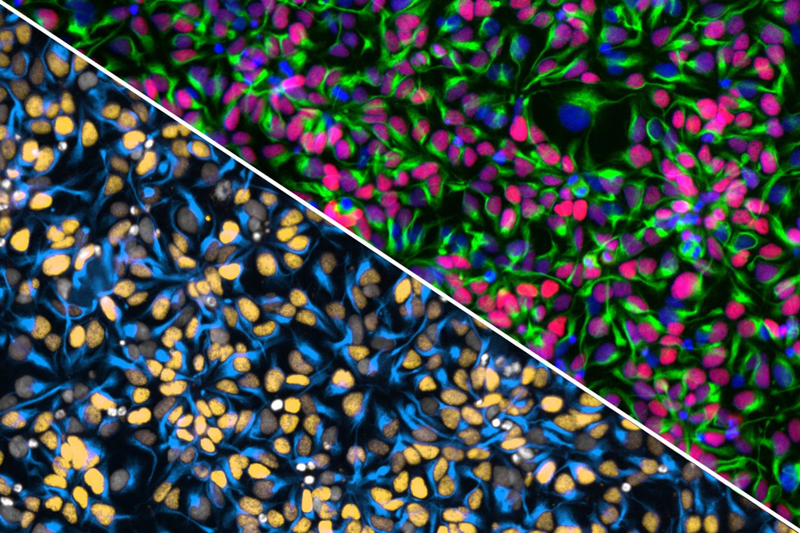 脳細胞の遺伝学を解析する「細胞ビレッジ」を開発 （What happens to brain cells in the ‘big city’?）