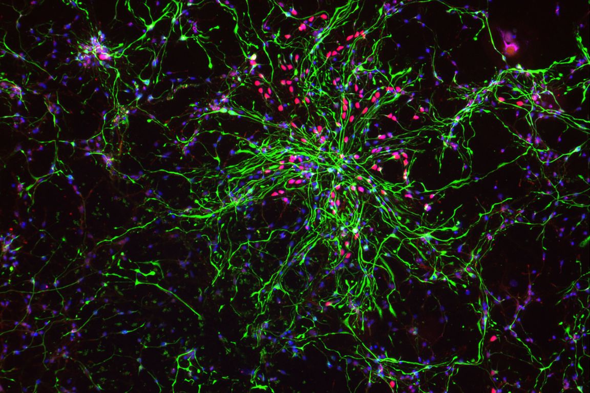 How the developing human brain takes instructions: Two UCLA studies reveal what guides its most important stem cells