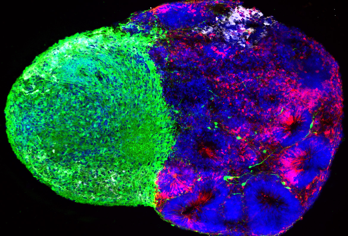 close Fluorescence microscopy image of a developing brain organoid, showing dense green, blue and magenta cellular regions.
