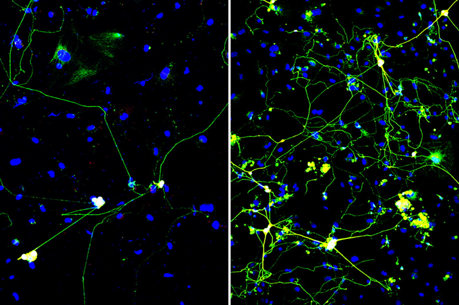 A split-screen microscopy image showing neurons with green fluorescent axons and dendrites against a black background with blue stained cell nuclei.