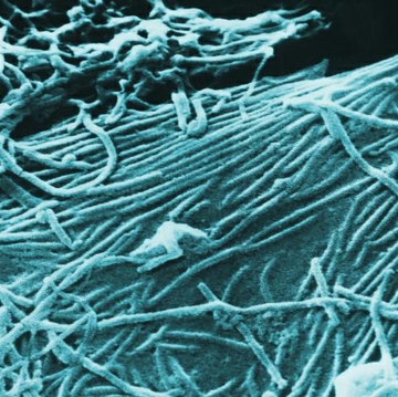 Ebola Virus Ebola Virus