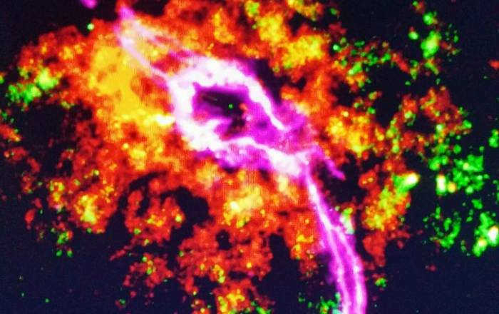 Orange color shows Inflammation response in the brain