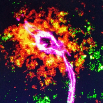 Orange color shows Inflammation response in the brain