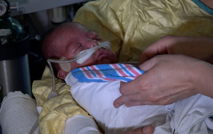 Dylan Waseta, born at over one pound, received donor milk