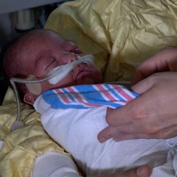 Dylan Waseta, born at over one pound, received donor milk