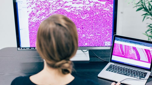 Aiforia Paves Path for AI-Assisted Pathology
