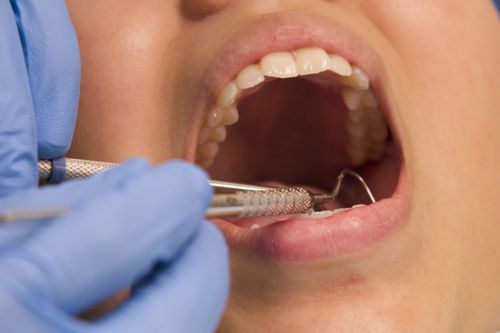 Dental exam - woman's mouth
