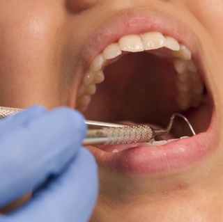 Dental exam - woman's mouth