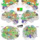 Dr. Fair and colleagues Dr.Dosenbach and Dr. Schlaggar develop method to approximate brain maturity with fMRI