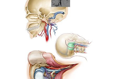 Hidden Treasure Andy Rekito: Neurological Surgery’s master medical illustrator 