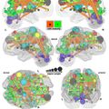 Dr. Fair and colleagues Dr.Dosenbach and Dr. Schlaggar develop method to approximate brain maturity with fMRI