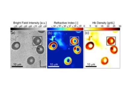OHSU Biomedical Engineers develop technique to determine the weight of particles so small, you need a microscope to see them