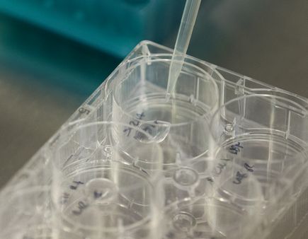 Promising microRNA study