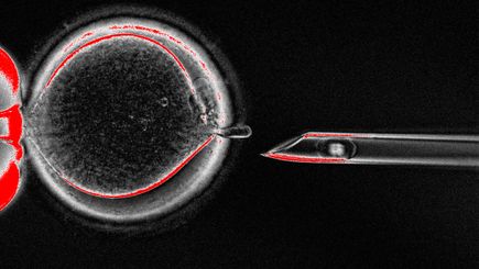 Mitochondrial replacement therapy