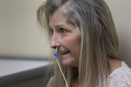 Surgery corrects dropped head syndrome 2016