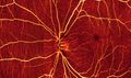 OCT-Angiography
