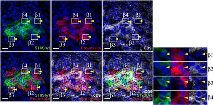 FIGURE 3: Grompe and colleagues found that hundreds of genes were differently expressed between cell subtypes and that they produced different amounts of insulin. 