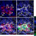 FIGURE 3: Grompe and colleagues found that hundreds of genes were differently expressed between cell subtypes and that they produced different amounts of insulin. 