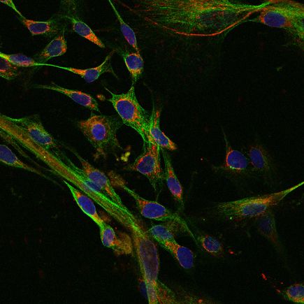 Study: Hidden genetic mutations in patient-derived stem cells could