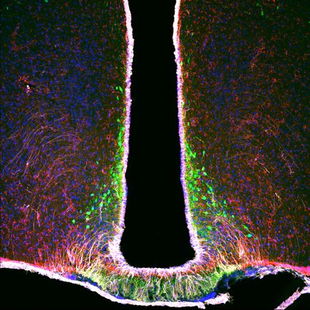 Confocal microscopy image of the medial basal hypothalamus illustrating the cellular complexity of this brain region.