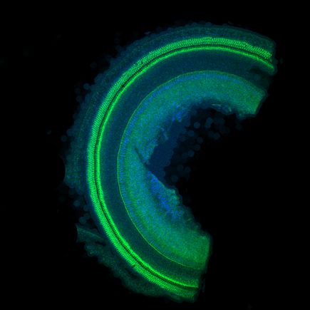 Lower power image of the cochlear coils, containing hair cells