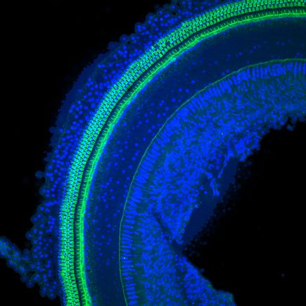 Lower power images of the cochlear coils, containing hair cells