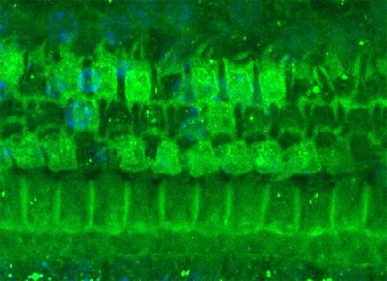 A damaged hair cell region with missing hair cells after treatment with kanamycin, in an endotxemic mouse