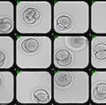 3-cell Stage