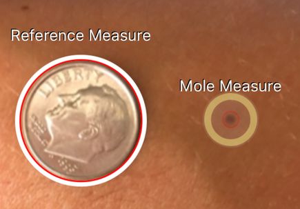 Mole Mapper app