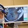 Deep brain stimulation